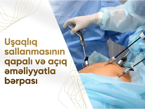 Uşaqlıq sallanmasının qapalı və açıq əməliyyatla bərpası