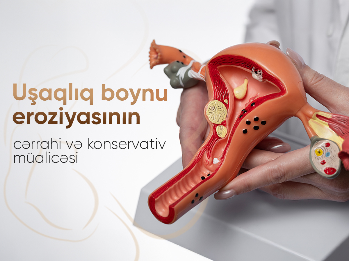 Uşaqlıq boynu eroziyasının cərrahi və konservativ müalicəsi