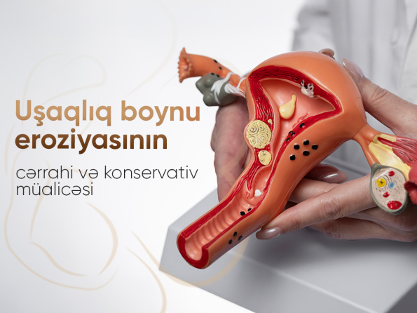 Uşaqlıq boynu eroziyasının cərrahi və konservativ müalicəsi